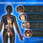 cathether for diagnostic