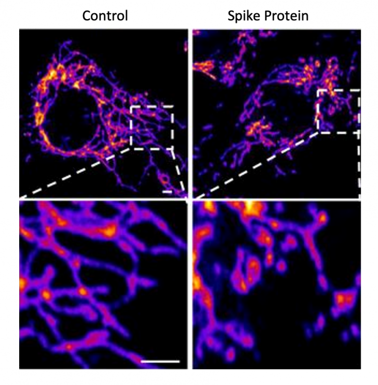 Representative images of vascular endothelial control cells (left) and cells treated with the SARS-CoV-2 Spike protein (right) show that the spike protein causes increased mitochondrial fragmentation in vascular cells. Click here for a high-resolution image. Credit: Salk Institute