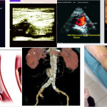 L'Angiologue prend en charge le diagnostic et le traitement de l’ensemble des pathologies des vaisseaux sanguins (artères, veines, lymphatiques) .